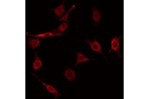 ABIN6274922 staining COLO205 by IF/ICC. (FAM203B antibody  (Internal Region))
