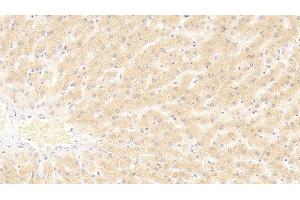 Detection of HNF4a in Human Liver Tissue using Polyclonal Antibody to Hepatocyte Nuclear Factor 4 Alpha (HNF4a) (HNF4A antibody  (AA 131-330))