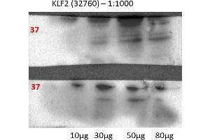 Human lung cell line