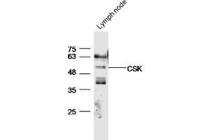 Mouse lymph node lysates probed with Anti-CSK Polyclonal Antibody, Unconjugated  at 1:5000 for 90 min at 37˚C. (CSK antibody  (AA 301-400))