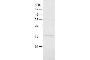 Western Blotting (WB) image for Enhancer of Split m8 Protein (E(SPL)M8-HLH) (AA 1-197) protein (His tag) (ABIN7287003) (Enhancer of Split m8 Protein (E(SPL)M8-HLH) (AA 1-197) protein (His tag))