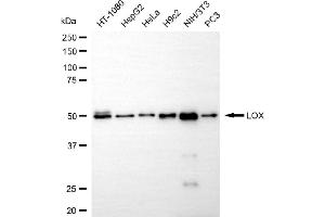anti-Lysyl Oxidase (LOX) antibody