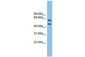 Image no. 1 for anti-C-Src tyrosine Kinase (CSK) (AA 323-372) antibody (ABIN6744928) (CSK antibody  (AA 323-372))