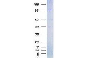 Validation with Western Blot