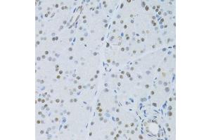 Immunohistochemistry of paraffin-embedded mouse pancreas using SNRNP70 antibody. (SNRNP70 antibody  (AA 150-250))