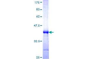 MARCH6 Protein (AA 2-91) (GST tag)