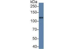 Western Blot; Sample: Rat Cerebrum lysate; Primary Ab: 5µg/ml Rabbit Anti-Rat Slit1 Antibody Second Ab: 0. (SLIT1 antibody  (AA 611-791))