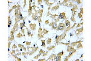 IHC analysis of paraffin-embedded human heart tissue, using SLN antibody (1/100 dilution, 40X lens). (SLN antibody)