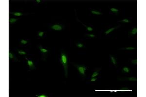 Immunofluorescence of monoclonal antibody to PDX1 on HeLa cell. (PDX1 antibody  (AA 109-208))