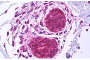 Anti-BAG1 antibody IHC staining of human breast, epithelium. (BAG1 antibody  (AA 241-346))