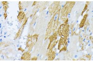 Immunohistochemistry of paraffin-embedded Rat heart using CALR Polyclonal Antibody at dilution of 1:100 (40x lens).