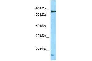 Western Blotting (WB) image for anti-Testis Expressed 35 (TEX35) (Middle Region) antibody (ABIN2506526) (TEX35 antibody  (Middle Region))