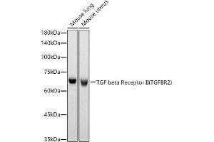 Western blot analysis of extracts of various cell lines, using TGF beta Receptor II (TGFBR2) antibody (ABIN6130736, ABIN6149086, ABIN6149089 and ABIN6218416) at 1:630 dilution. (TGFBR2 antibody  (AA 23-280))
