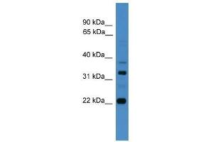AMZ2 antibody used at 0. (AMZ2 antibody  (C-Term))