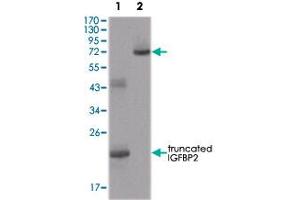 Western blot analysis using IGFBP2 monoclonal antibody, clone 1F6F6  against truncated IGFBP2-His recombinant protein (1) and truncated IGFBP2 (aa 40-328)-hIgGFc transfected CHO-K1 cell lysate (2).