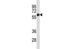 Placental Alkaline Phosphatase antibody western blot analysis in HepG2 lysate (Alkaline Phosphatase antibody  (AA 56-83))