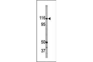 The anti-Phospho-Rb-like-1- Pab (ABIN389640 and ABIN2839632) is used in Western blot to detect Phospho-Rb-like-1- in  tissue lysate (p107 antibody  (pSer975))