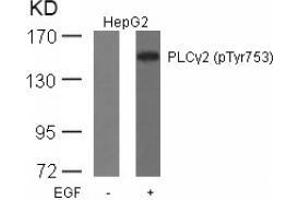 Image no. 1 for anti-Phospholipase C gamma 2 (PLCG2) (pTyr753) antibody (ABIN196907) (Phospholipase C gamma 2 antibody  (pTyr753))