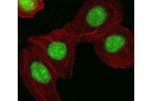 Fluorescent image of A549 cell stained with HMGA1 antibody at 1:25. (HMGA1 antibody  (AA 64-93))