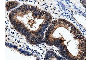 Immunohistochemical staining of paraffin-embedded Human Kidney tissue using anti-AK5 mouse monoclonal antibody. (Adenylate Kinase 5 antibody)
