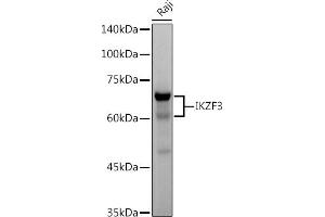 Western blot analysis of extracts of Raji cells, using IKZF3 antibody (ABIN7267842) at 1:500 dilution.