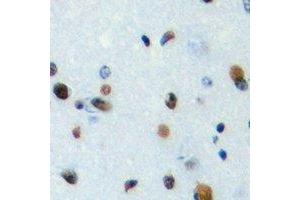 Immunohistochemical analysis of TEF staining in human brain formalin fixed paraffin embedded tissue section. (TEF antibody  (C-Term))