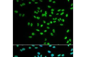 Immunofluorescence analysis of MCF-7 cells using FANCD2 Polyclonal Antibody (FANCD2 antibody)