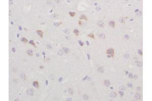 Formalin-fixed and paraffin embedded rat brain labeled with Rabbit Anti-TGM2 Polyclonal Antibody, Unconjugated  at 1:200 followed by conjugation to the secondary antibody and DAB staining (Transglutaminase 2 antibody  (AA 551-650))