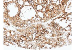IHC-P Image Immunohistochemical analysis of paraffin-embedded human Breast, using ALPPL2, antibody at 1:500 dilution. (ALPPL2 antibody  (Center))