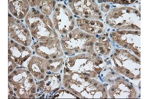 Immunohistochemistry (IHC) image for anti-Acetyl-CoA Acetyltransferase 2 (ACAT2) antibody (ABIN1496397) (ACAT2 antibody)