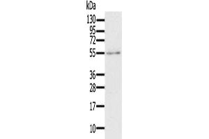 Gel: 6 % SDS-PAGE, Lysate: 40 μg, Lane: A172 cells, Primary antibody: ABIN7192209(RORB Antibody) at dilution 1/200, Secondary antibody: Goat anti rabbit IgG at 1/8000 dilution, Exposure time: 1 minute (RORB antibody)