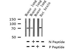 Western blot analysis of Phospho-DRP-2 (Thr514) expression in various lysates (DPYSL2 antibody  (pThr514))