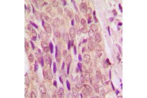 Immunohistochemistry (IHC) image for anti-SMAD Family Member 4 (SMAD4) (N-Term) antibody (ABIN7296234)
