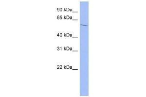 IGF2BP2 antibody used at 1 ug/ml to detect target protein. (IGF2BP2 antibody  (Middle Region))