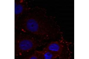 Immunofluorescence staining of methanol-fixed Hela cells using Paxillin(phospho-Tyr88) Antibody. (Paxillin antibody  (pTyr88))