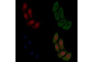 ABIN6255221 and ABIN6267478 staining HepG2 cells(4h of LPS treatment) by IF/ICC. (beta Catenin antibody  (pSer33))