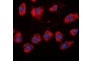 Immunofluorescent analysis of Beta-adducin staining in HeLa cells. (ADD2 antibody)
