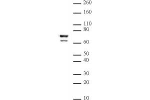 Lamin A/C mAb (Clone 3A6-4C11) tested by Western blot. (Lamin A/C antibody  (AA 430-545))