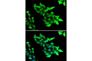 Immunofluorescence analysis of HeLa cells using KRIT1 antibody (ABIN5974145). (KRIT1 antibody)