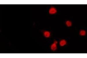 ABIN6272320 staining Hela by IF/ICC. (HDAC9 antibody  (C-Term))