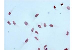 Immunocytochemistry analysis of ABIN7127269 diluted at 1:100 and staining in Hela cells performed on a Leica BondTM system. (Recombinant HIST1H3A antibody  (H3K4ac))