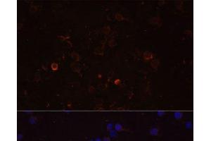 Immunofluorescence analysis of THP-1 cells using TLR4 Polyclonal Antibody at dilution of 1:100 (40x lens). (TLR4 antibody)