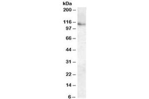 Western blot testing of human kidney lysate with ATP13A1 antibody at 0. (ATP13A1 antibody)