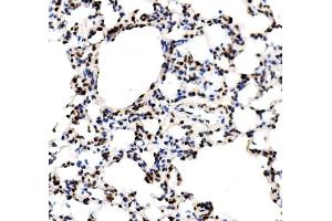 IHC analysis of RCC1 using anti-RCC1 antibody (ABIN7600024).