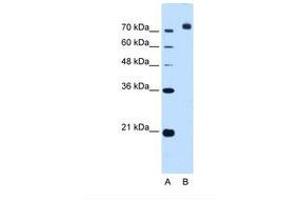 Image no. 1 for anti-Corin, Serine Peptidase (CORIN) (AA 881-930) antibody (ABIN321147) (Corin antibody  (AA 881-930))