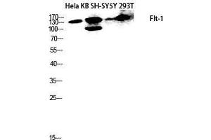Western Blot (WB) analysis of HeLa, KB, SH-SY5Y, 293T lysis using Flt-1 antibody. (FLT1 antibody  (Ser385))