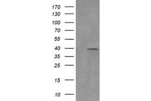 Image no. 6 for anti-Mitogen-Activated Protein Kinase Kinase 3 (MAP2K3) antibody (ABIN1499405) (MAP2K3 antibody)