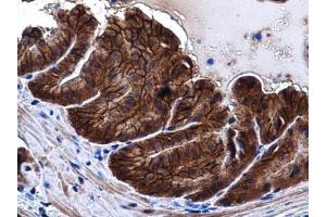 IHC-P Image E-Cadherin antibody detects E-Cadherin protein at cell membrane and cytoplasm in mouse prostate by immunohistochemical analysis. (E-cadherin antibody)
