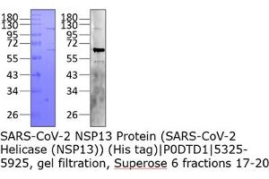 Western Blotting (WB) image for SARS-CoV-2 Helicase (NSP13) (HEL) protein (His tag) (ABIN6952696) (SARS-CoV-2 NSP13 Protein (His tag))