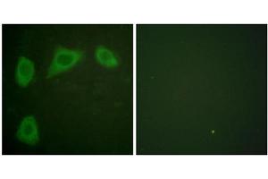 Immunofluorescence analysis of HuvEc cells, using Caveolin 1 antibody. (Caveolin-1 antibody  (C-Term))